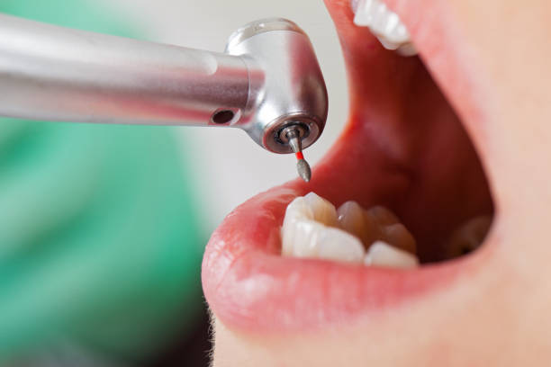 Best Emergency Treatment for Oral Infections in Hillsboro Beach, FL